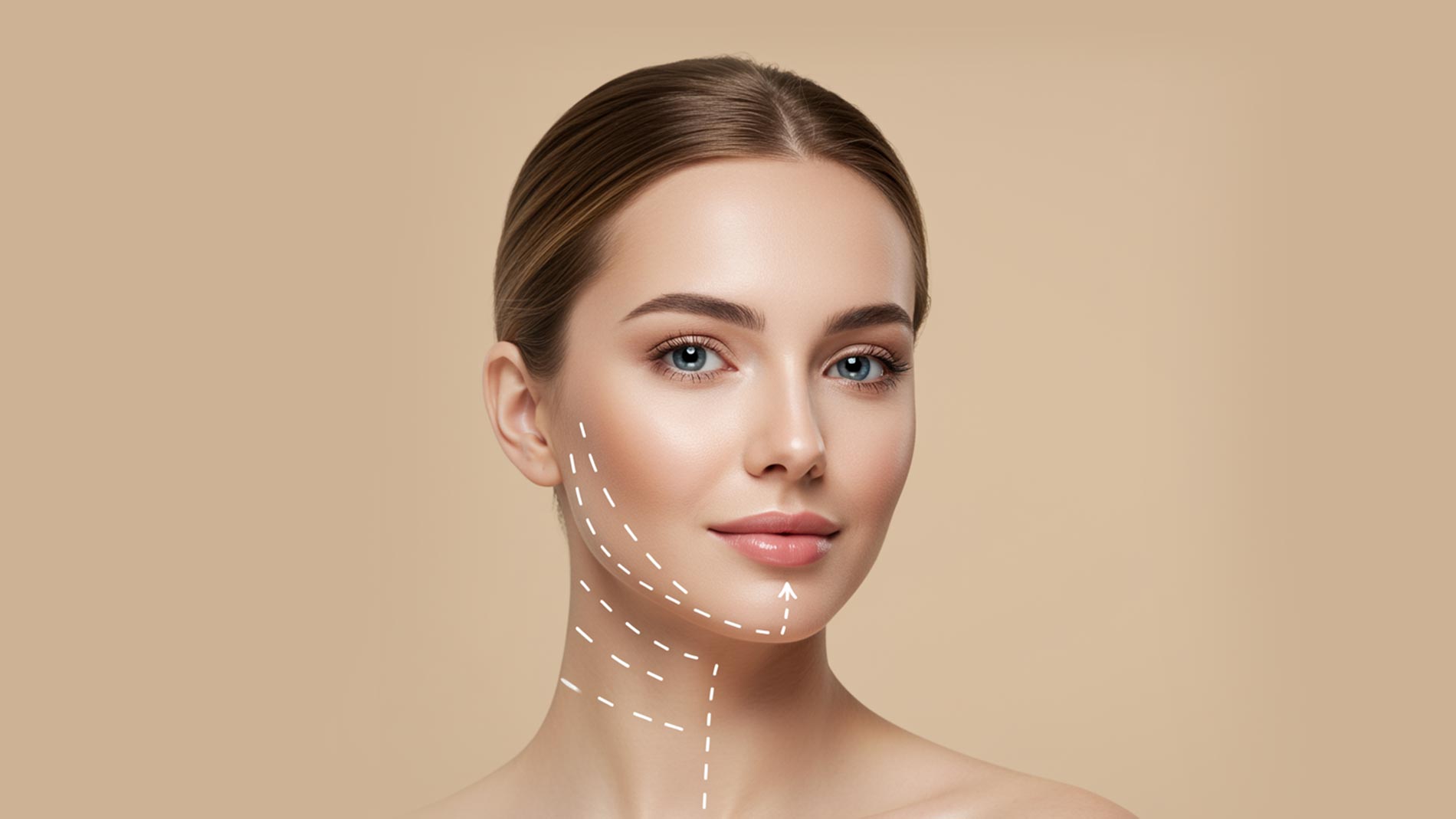 Jawline Unterspritzung in Neuss