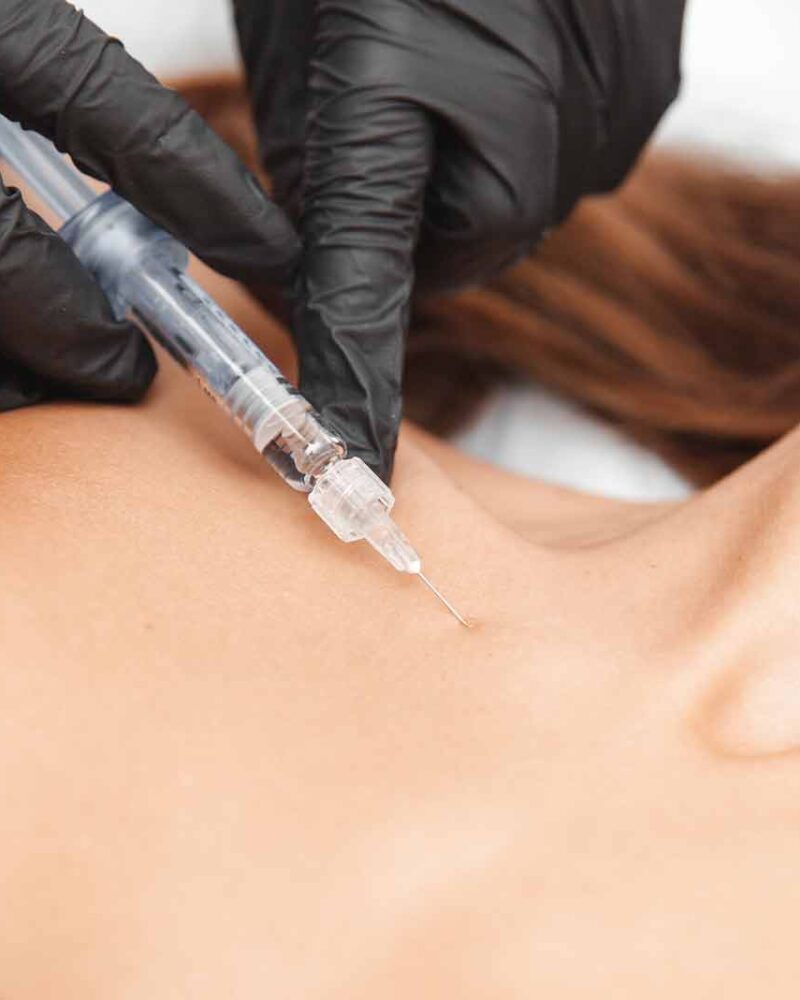 Mesotherapie für Hände, Hals & Dekolleté: Vergessene Hautpartien